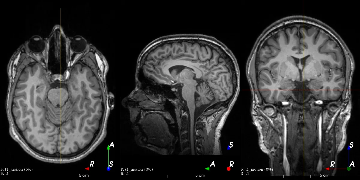 Original brain scan
